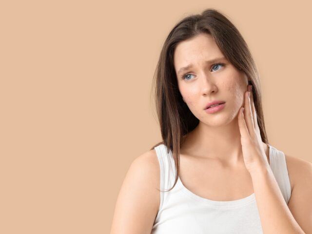 How Can I Improve My Skin Texture After Acne?