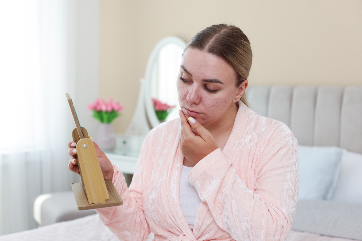 Woman examining acne scars in a mirror wondering if microneedling for acne scars works