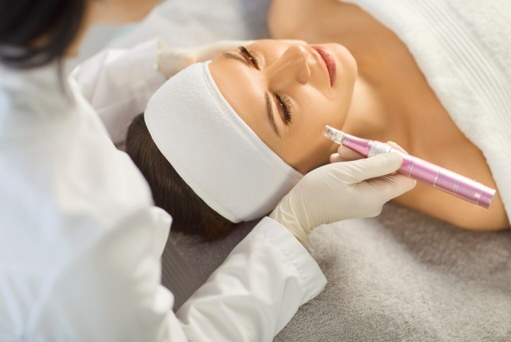 Provider performing microneedling treatment on patient's cheek with a microneedling pen