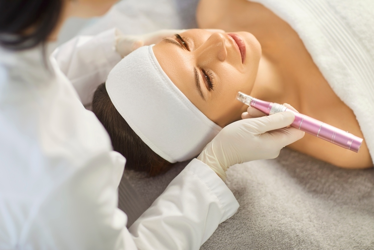 What Is Microneedling and How Does It Actually Work?