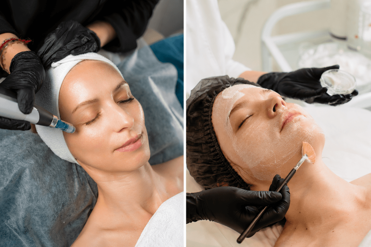 Split comparison of microneedling vs chemical peels treatment sessions