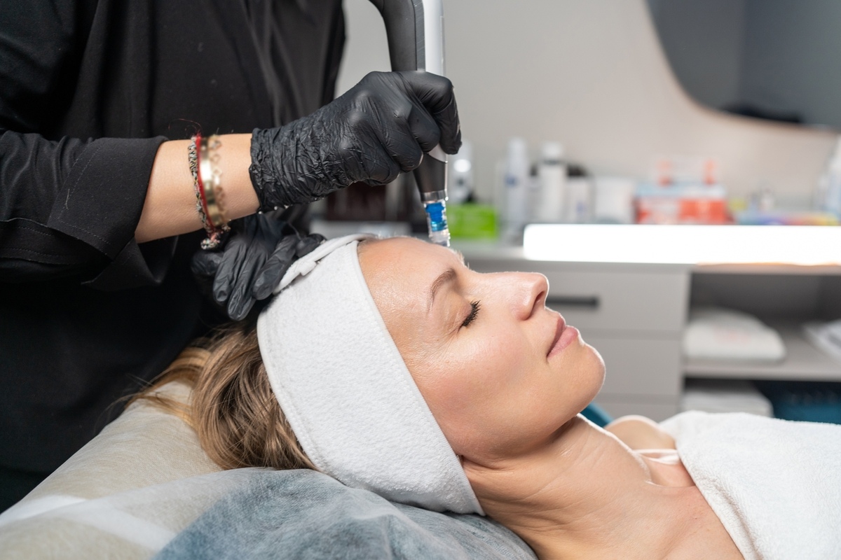 Microneedling in Cypress, TX | Skin 101