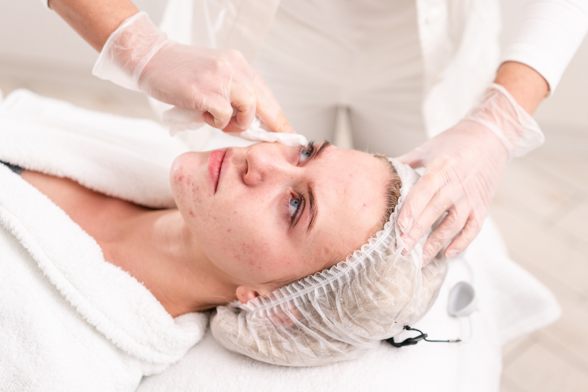 Provider cleansing a patient's face before acne scar treatment in Cypress, TX